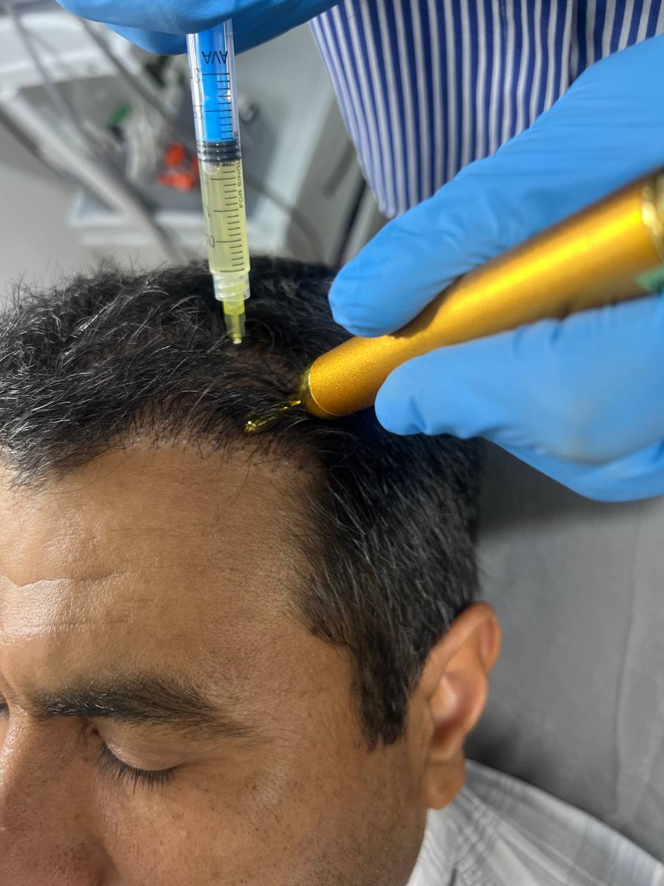  نمونه کار پی آر پی مو