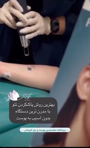 ریمو وتتو