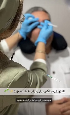 بوتاکس
