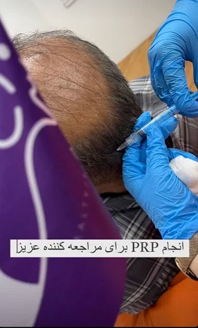 پی آر پی